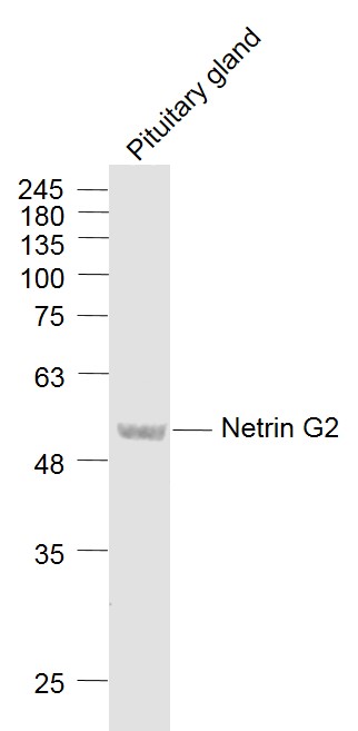 1 - Netrin G2 Rabbit pAb AP54374
