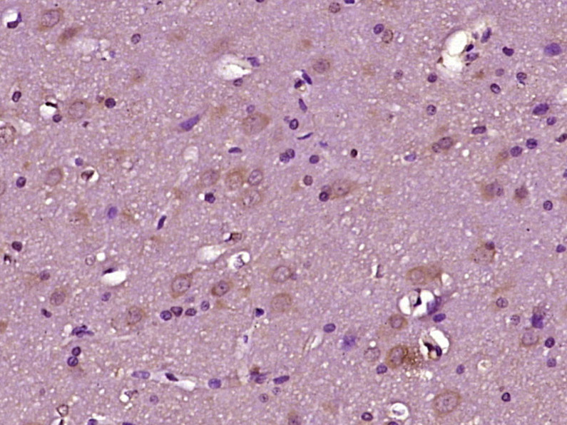 14 - NRXN2 Rabbit pAb AP54375