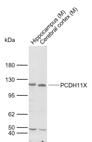 1 - PCDH11X Rabbit pAb AP54378
