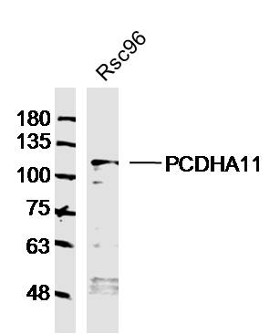 1 - PCDHA11 Rabbit pAb AP54389