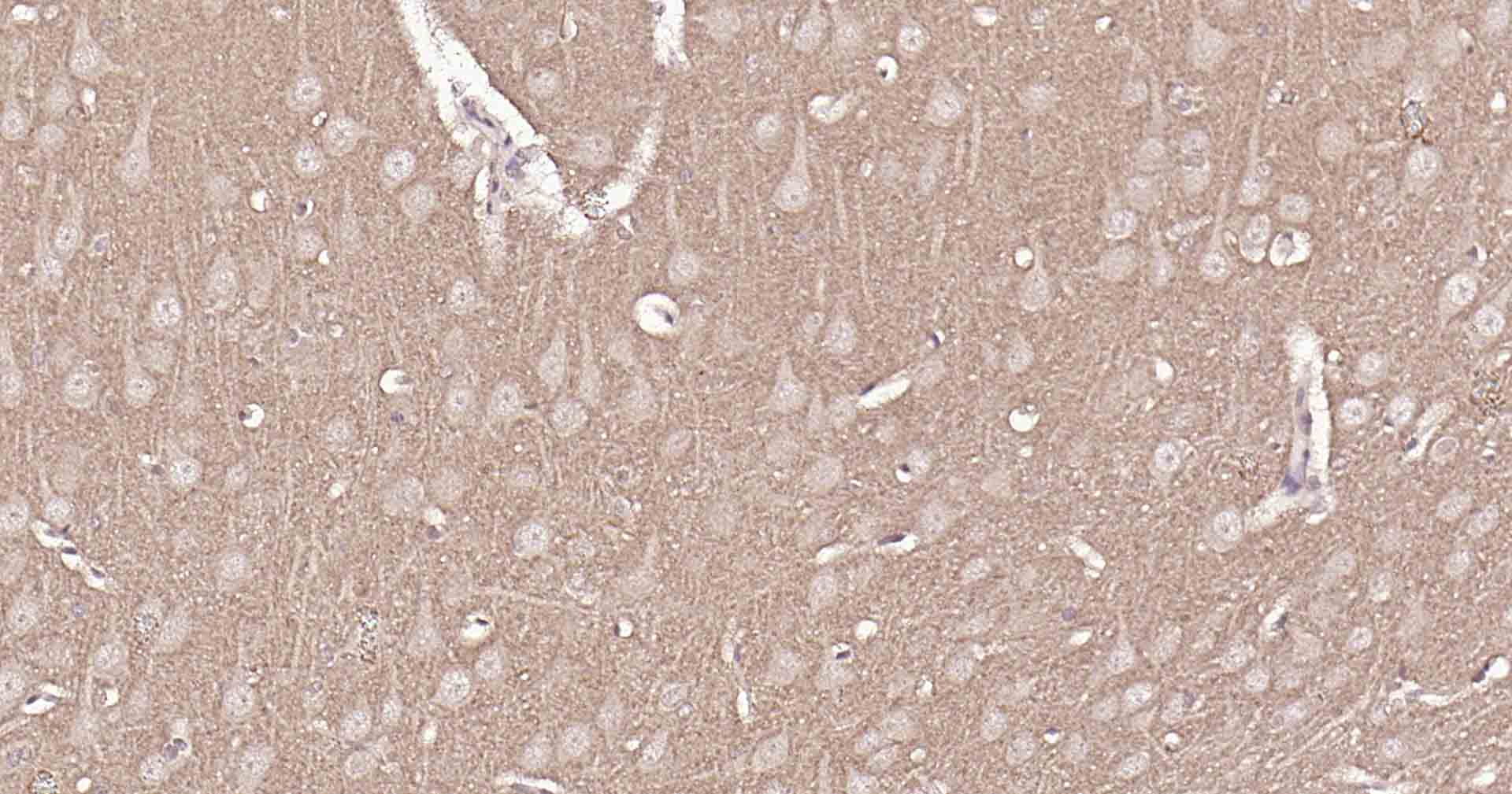 14 - VGLUT1/BNP1 Rabbit pAb AP54412