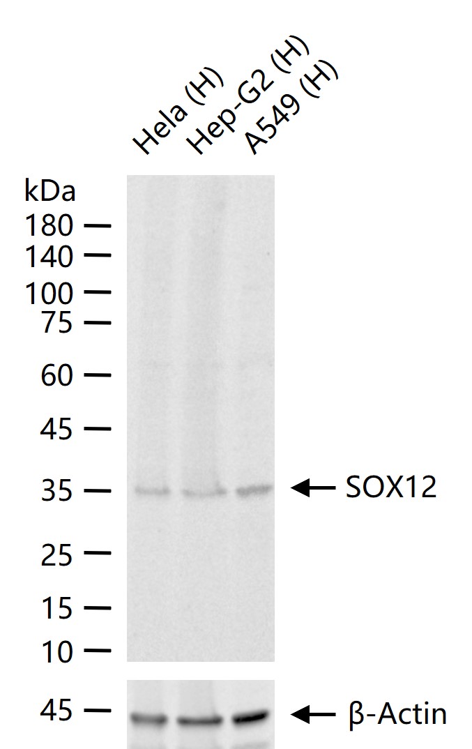 1 - SOX12 Rabbit pAb AP54425