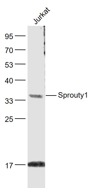 1 - Sprouty1 Rabbit pAb AP54427