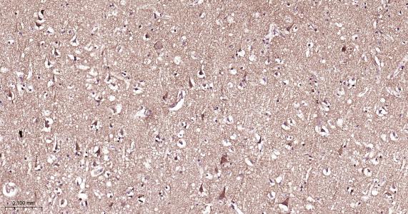 14 - RAB10 Rabbit pAb AP54435