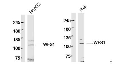 1 - WFS1 Rabbit pAb AP54440