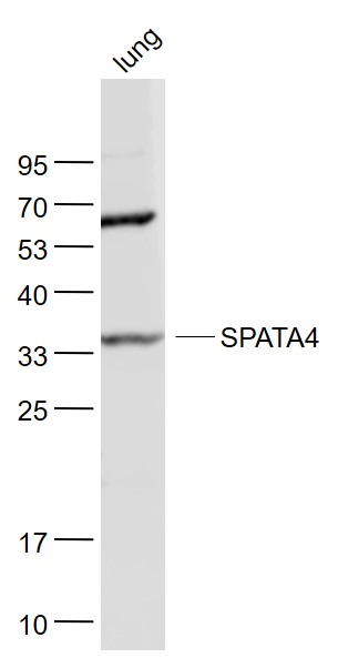 1 - TSARG2/SPATA4 Rabbit pAb AP54449