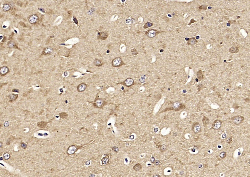 14 - KIF1A Rabbit pAb AP54465