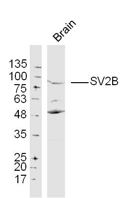 1 - SV2B Rabbit pAb AP54472