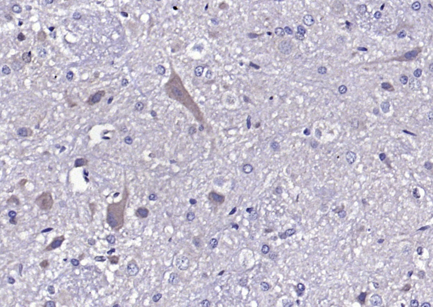 14 - SV2B Rabbit pAb AP54472