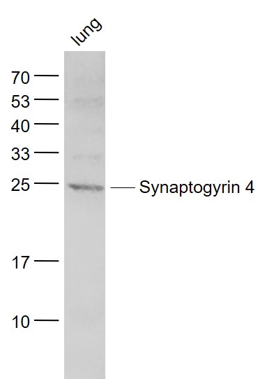 1 - Synaptogyrin 4 Rabbit pAb AP54474