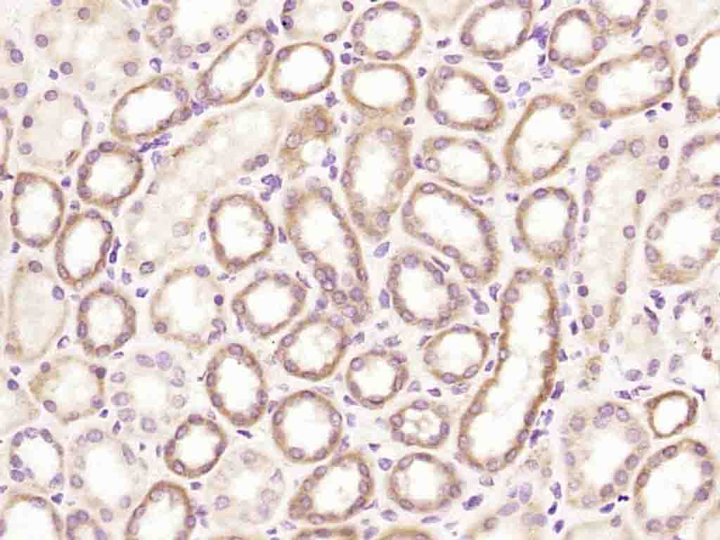 14 - A2LD1 Rabbit pAb AP54477