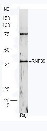 1 - RNF39 Rabbit pAb AP54485