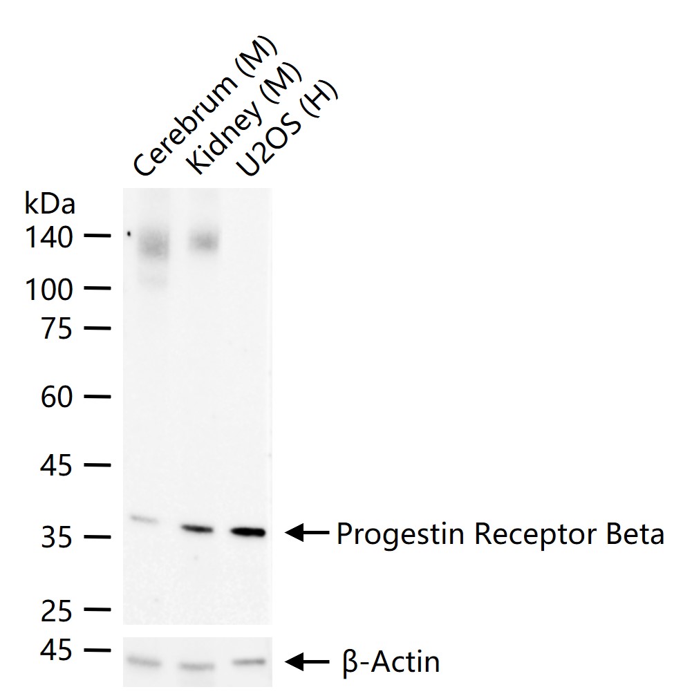 1 - Progestin Receptor Beta Rabbit pAb AP54490