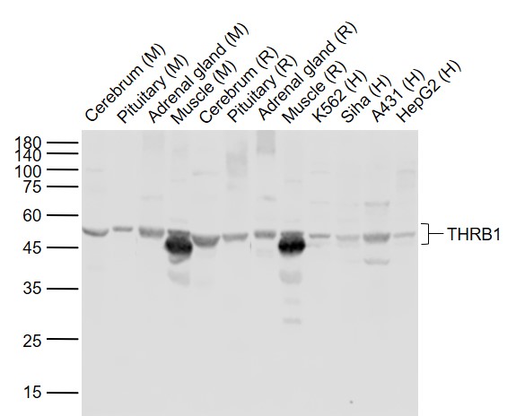 1 - THRB1 Rabbit pAb AP54503