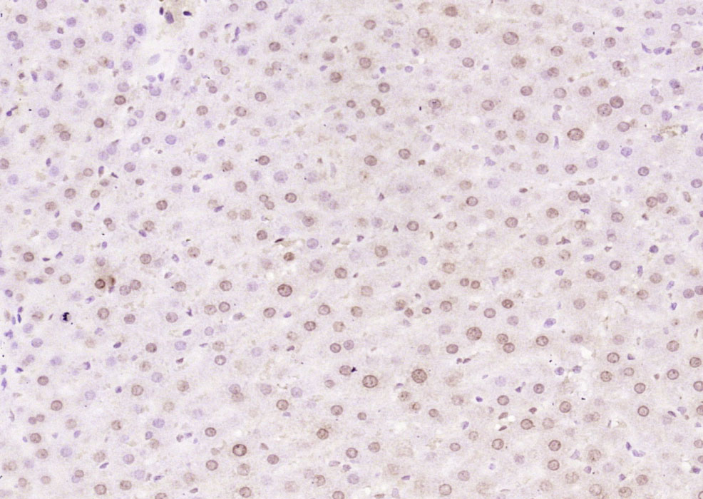 14 - THRB1 Rabbit pAb AP54503