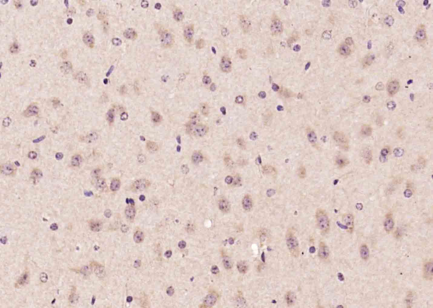 14 - Advillin Rabbit pAb AP54508