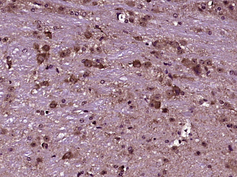 14 - PLXNB3 Rabbit pAb AP54515