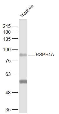 1 - RSPH4A Rabbit pAb AP54516