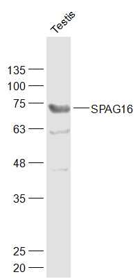 1 - SPAG16 Rabbit pAb AP54520