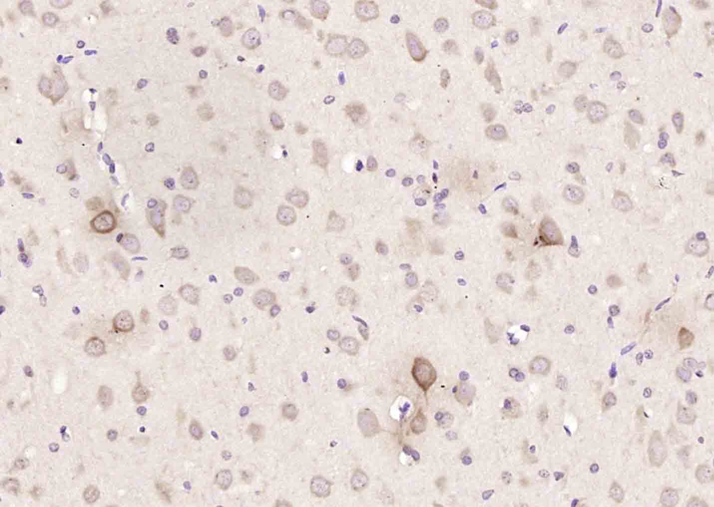 14 - SORCS3 Rabbit pAb AP54526