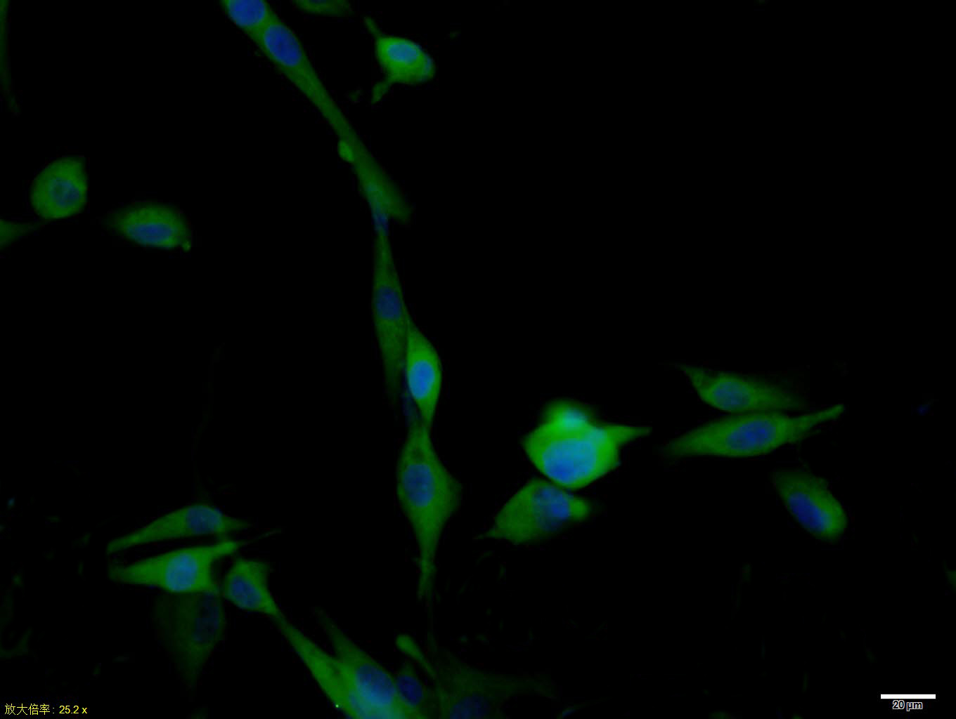 0 - BBS1 Rabbit pAb AP54528
