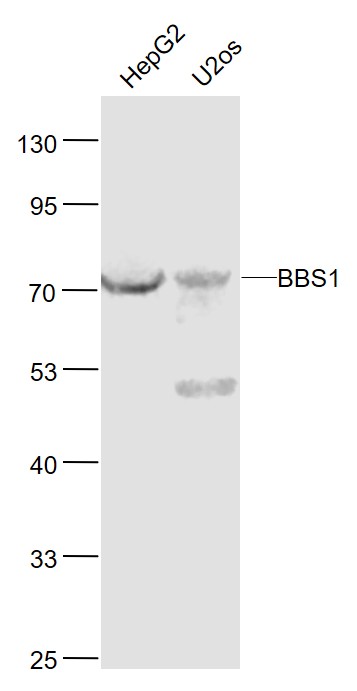 1 - BBS1 Rabbit pAb AP54528