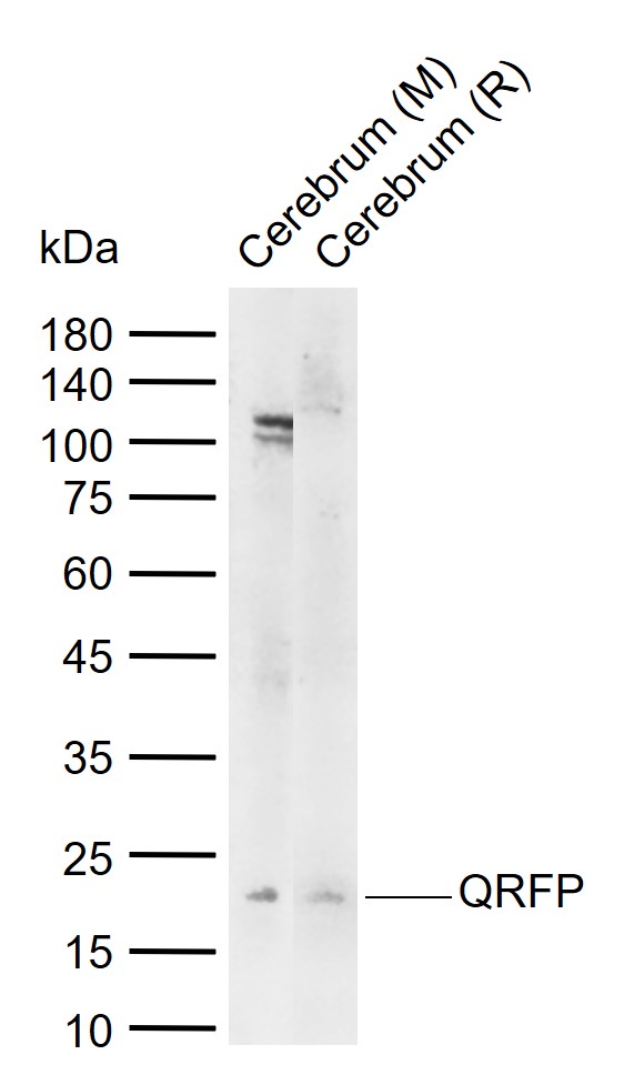 1 - QRFP Rabbit pAb AP54536