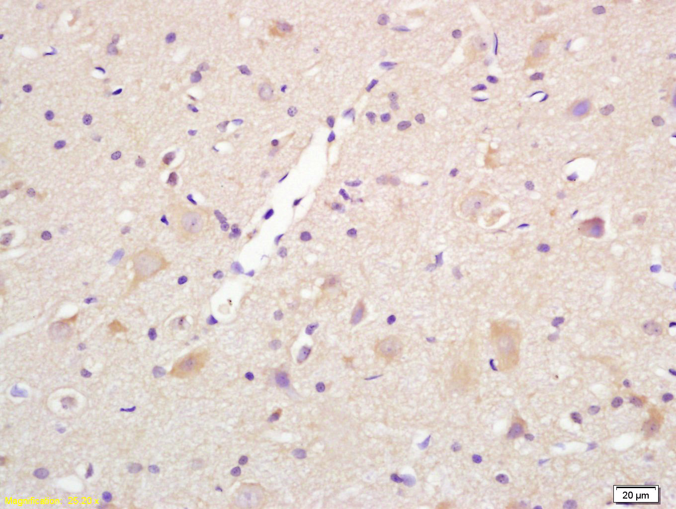 14 - Centaurin alpha 1 Rabbit pAb AP54539