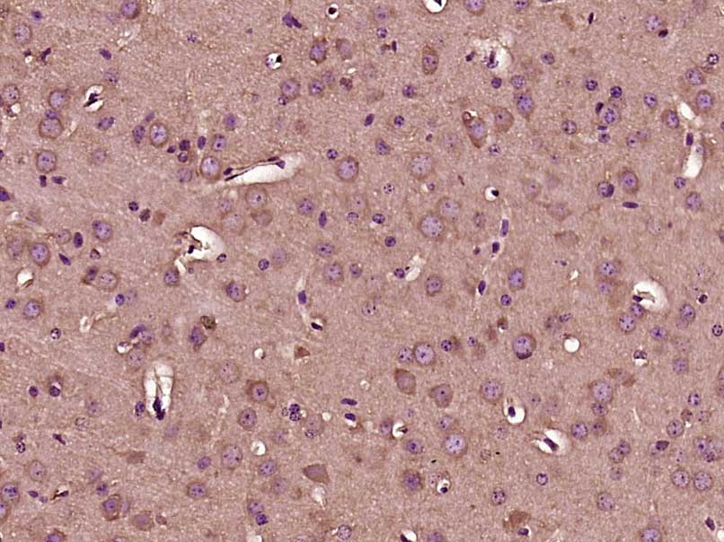 14 - Gemin 1 Rabbit pAb AP54544