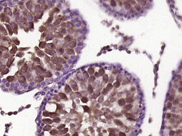 14 - Gli3 Rabbit pAb AP54547