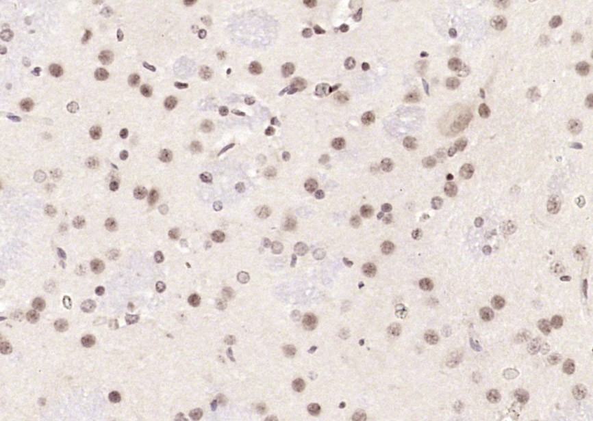 14 - Neuro D Rabbit pAb AP54551
