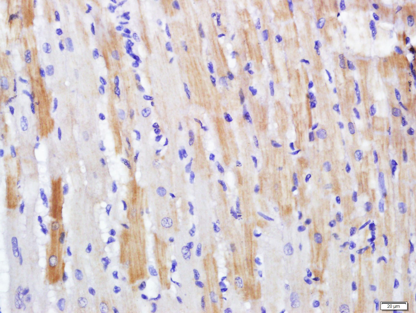 14 - PDE7A Rabbit pAb AP54552