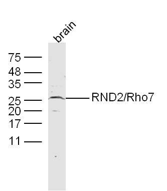 1 - RND2/Rho7 Rabbit pAb AP54556