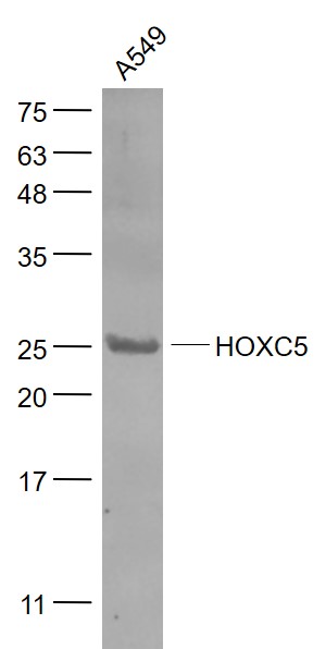 1 - HOXC5 Rabbit pAb AP54559