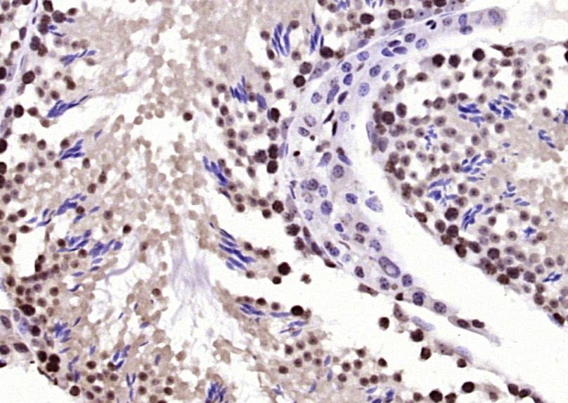 14 - BPTF Rabbit pAb AP54575