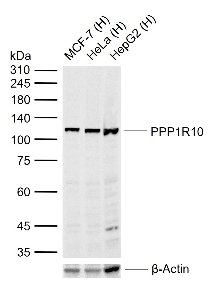1 - PPP1R10 Rabbit pAb AP54589
