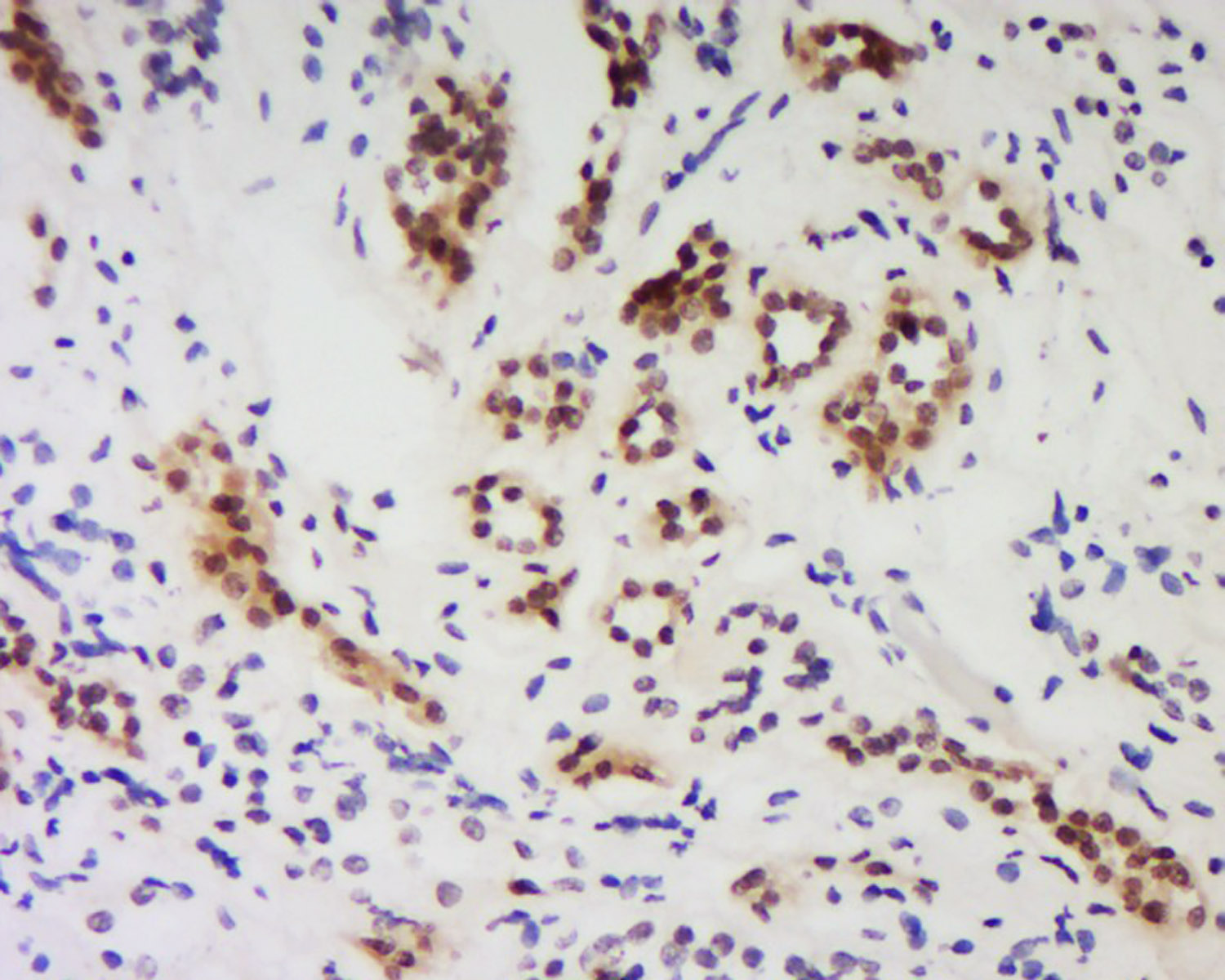 14 - PPP1R10 Rabbit pAb AP54589