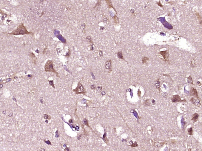 14 - UBXD2 Rabbit pAb AP54592