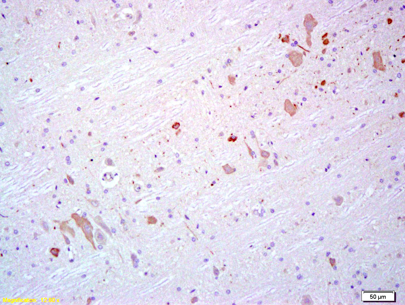 14 - HECW1 Rabbit pAb AP54597