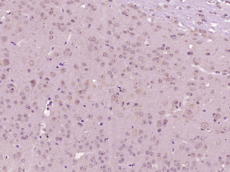 14 - Senataxin Rabbit pAb AP54598