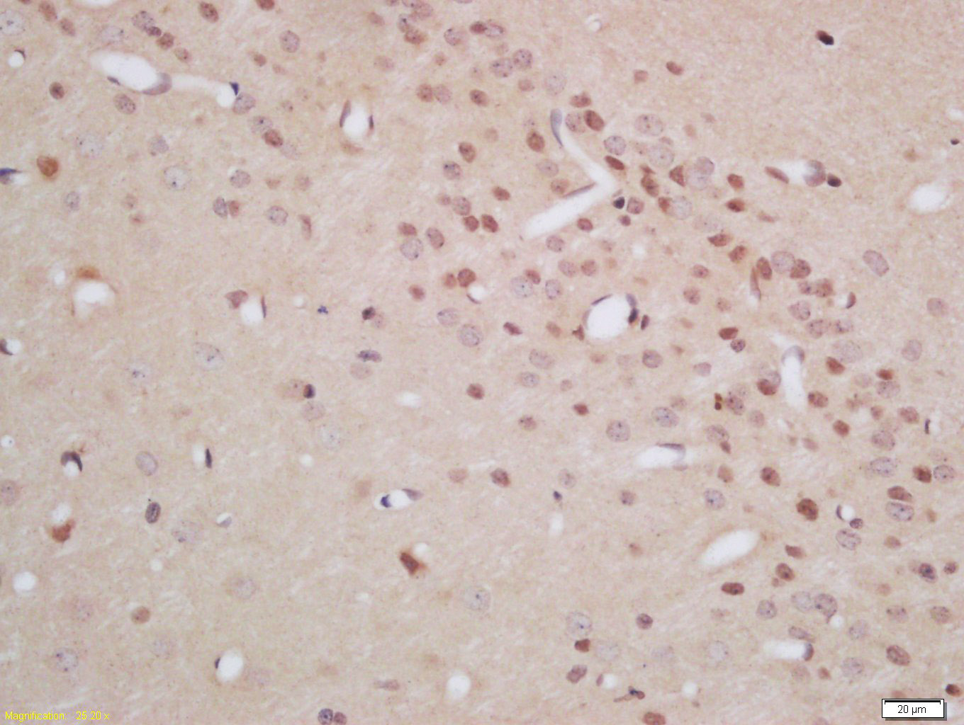 14 - CRBN Rabbit pAb AP54605