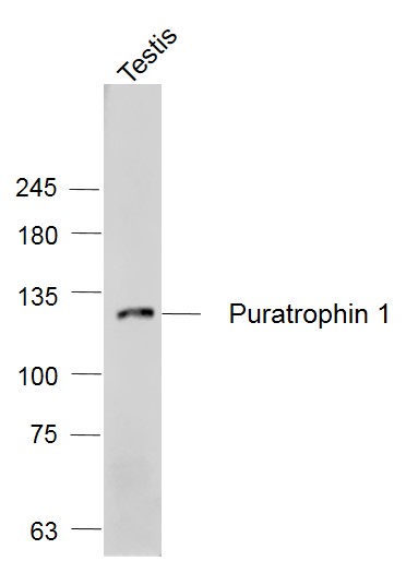1 - Puratrophin 1 Rabbit pAb AP54615