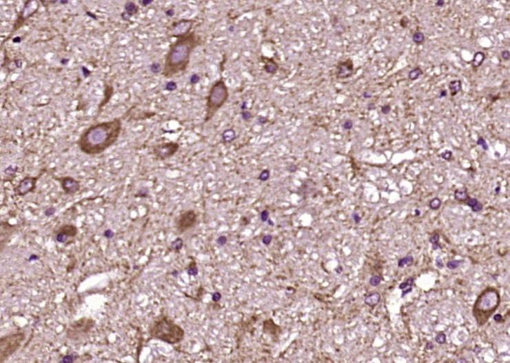 14 - Puratrophin 1 Rabbit pAb AP54615
