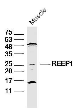 1 - REEP1 Rabbit pAb AP54618