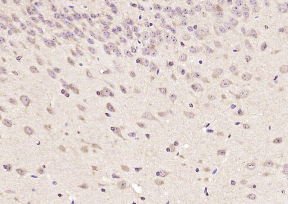 14 - SMUBP2 Rabbit pAb AP54619