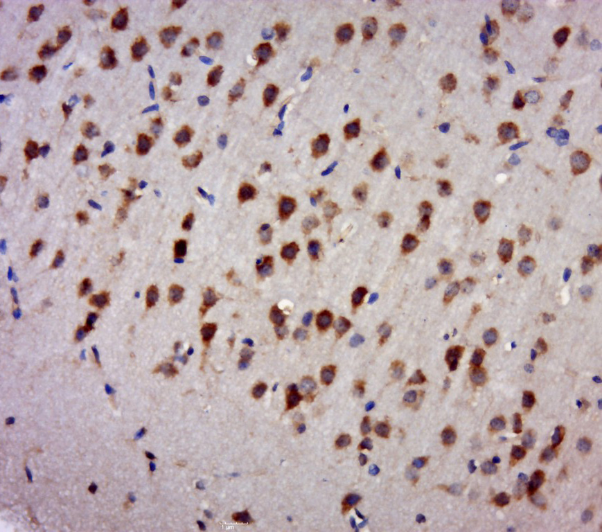 14 - TDRD3 Rabbit pAb AP54621