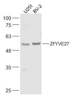 1 - ZFYVE27 Rabbit pAb AP54623