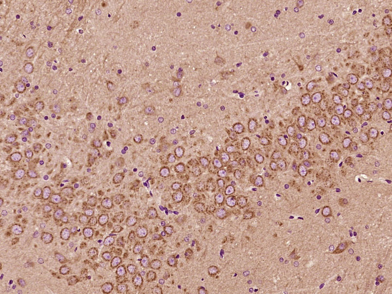 14 - ZFYVE27 Rabbit pAb AP54623