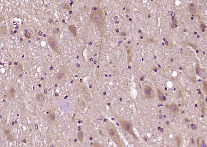 14 - RTN1 Rabbit pAb AP54626