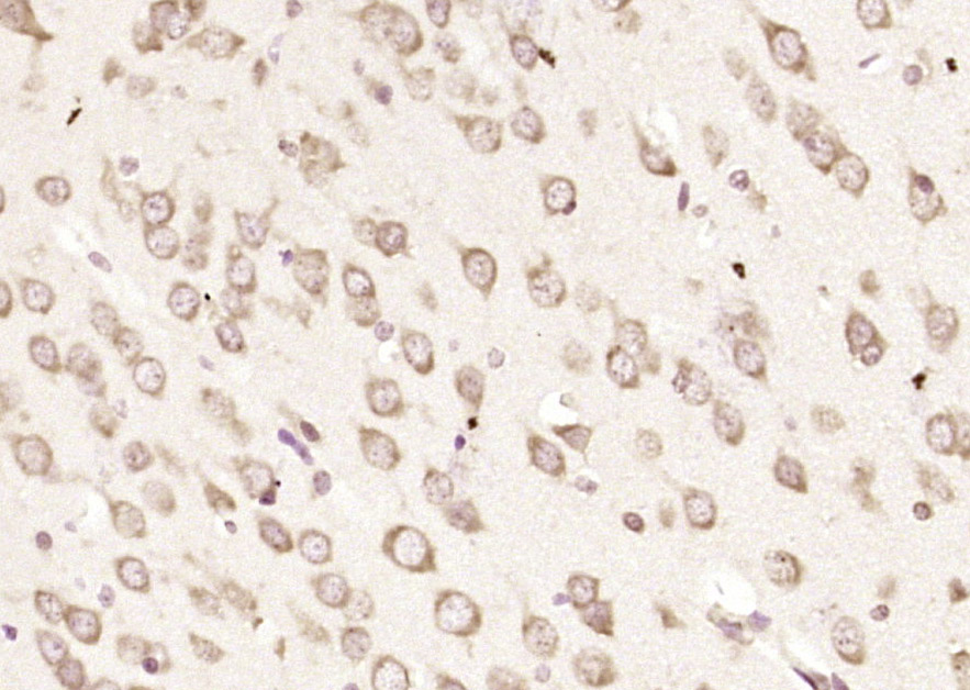 14 - CSAD Rabbit pAb AP54636